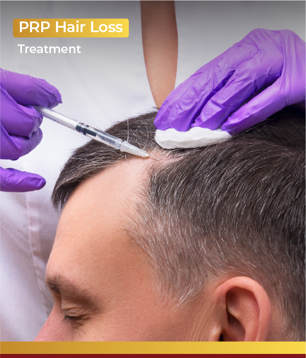 PRP Hair Treatment